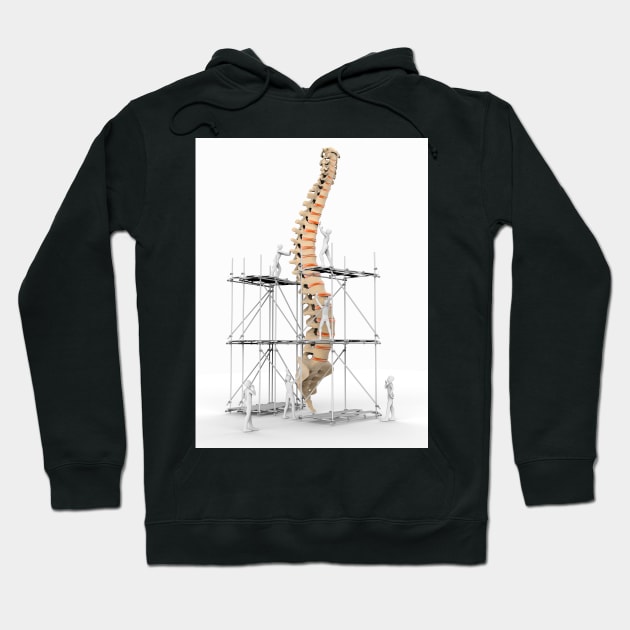 Spine with workers, spine repair (F007/9884) Hoodie by SciencePhoto